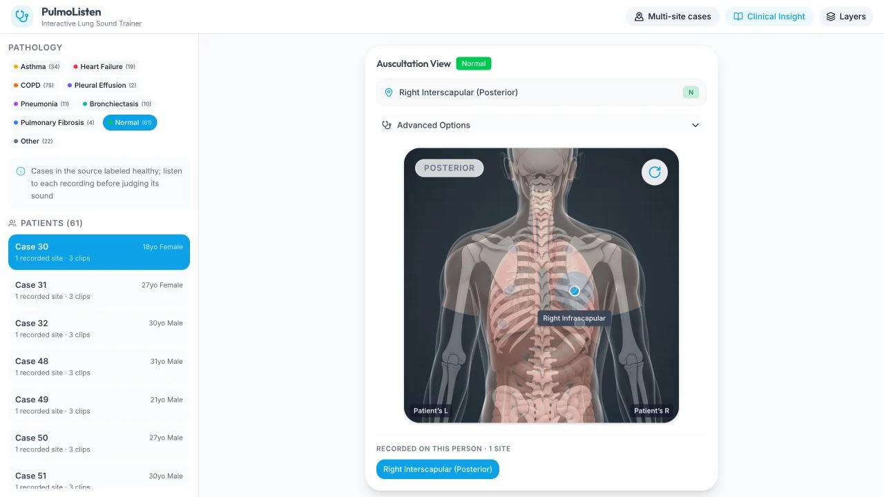 PulmoListen’s live interface showing a case library and layered chest anatomy with a recorded listening site.